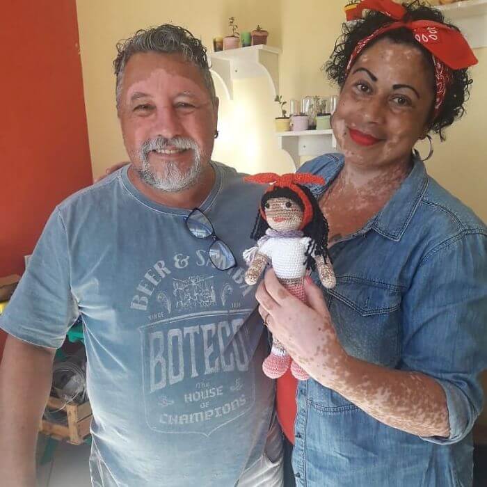 revistacarpediem.com - Senhor com vitiligo faz bonecas de crochê para que crianças se sintam bem com a aparência