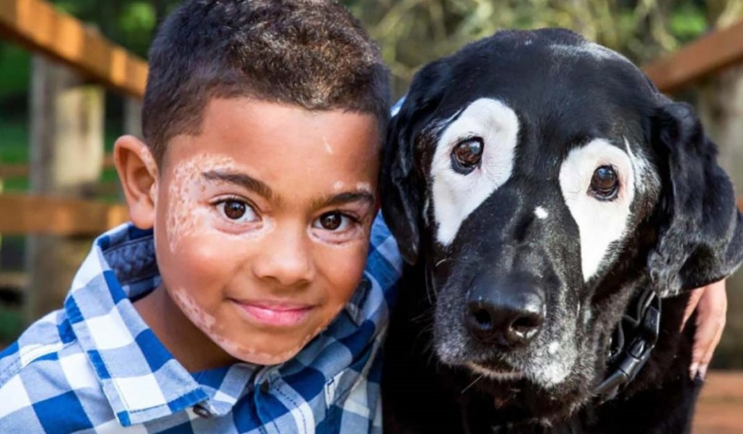 Conheça Carter, o menino com vitiligo que começou a se aceitar ao conhecer um cão como ele