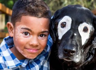 Conheça Carter, o menino com vitiligo que começou a se aceitar ao conhecer um cão como ele