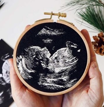 Mãe borda fotos de ultrassom e a lista de pedidos não para de crescer