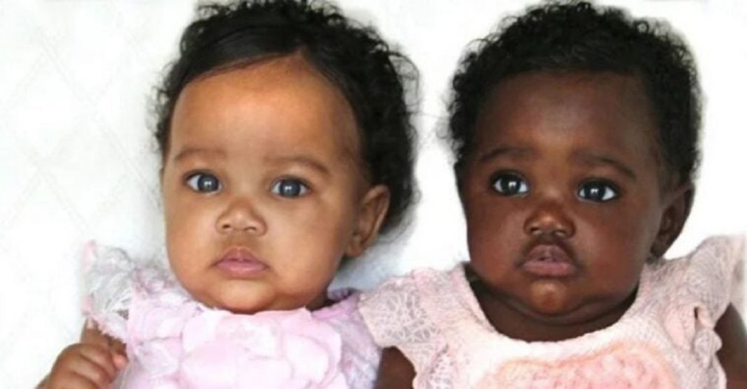 Gêmeas que nasceram com cores de pele diferentes ainda encantam internautas
