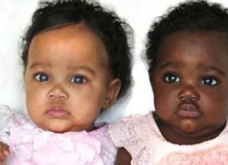 Gêmeas que nasceram com cores de pele diferentes ainda encantam internautas