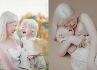 Irmãs albinas encantam o mundo com um ensaio fotográfico fantástico