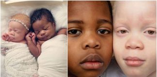 Gêmeos de tons de pele diferentes arrebatam mãe no nascimento