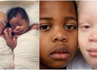 Gêmeos de tons de pele diferentes arrebatam mãe no nascimento