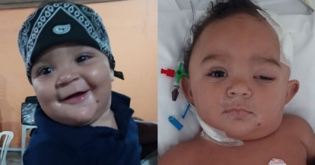 Bebê passa por cirurgias cerebrais e vai parar na UTI após se jogar do colo de irmã: ‘Estar vivo é uma glória’