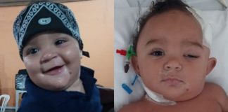 Bebê passa por cirurgias cerebrais e vai parar na UTI após se jogar do colo de irmã: ‘Estar vivo é uma glória’