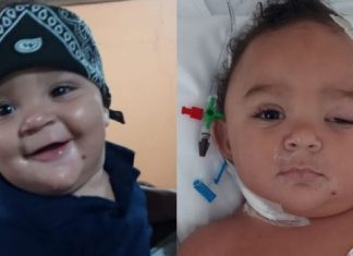 Bebê passa por cirurgias cerebrais e vai parar na UTI após se jogar do colo de irmã: ‘Estar vivo é uma glória’