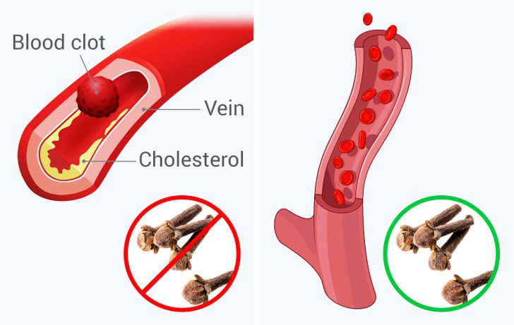 revistacarpediem.com - O que acontece com seu corpo se você começar a comer 2 cravos por dia